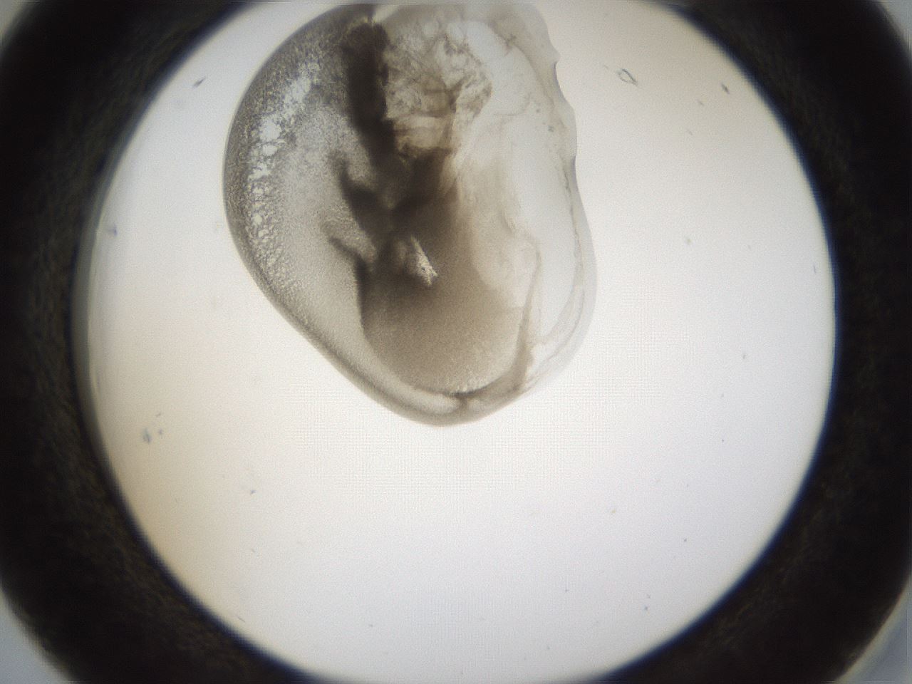 folderID160_plateID1160_batchID3204_wellNum18_profileID1_d2_r62274_ef.jpg