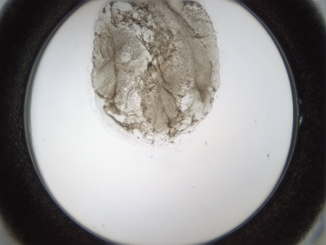 folderID160_plateID1160_batchID3204_wellNum1_profileID1_d2_r62240_ef.jpg