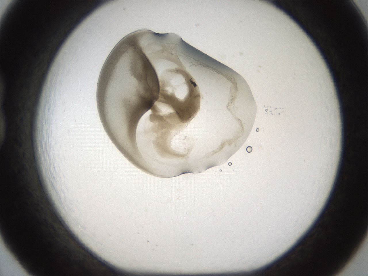 folderID160_plateID1160_batchID3204_wellNum20_profileID1_d1_r62277_ef.jpg