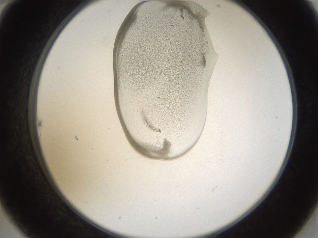 folderID160_plateID1160_batchID3204_wellNum22_profileID1_d2_r62282_ef.jpg