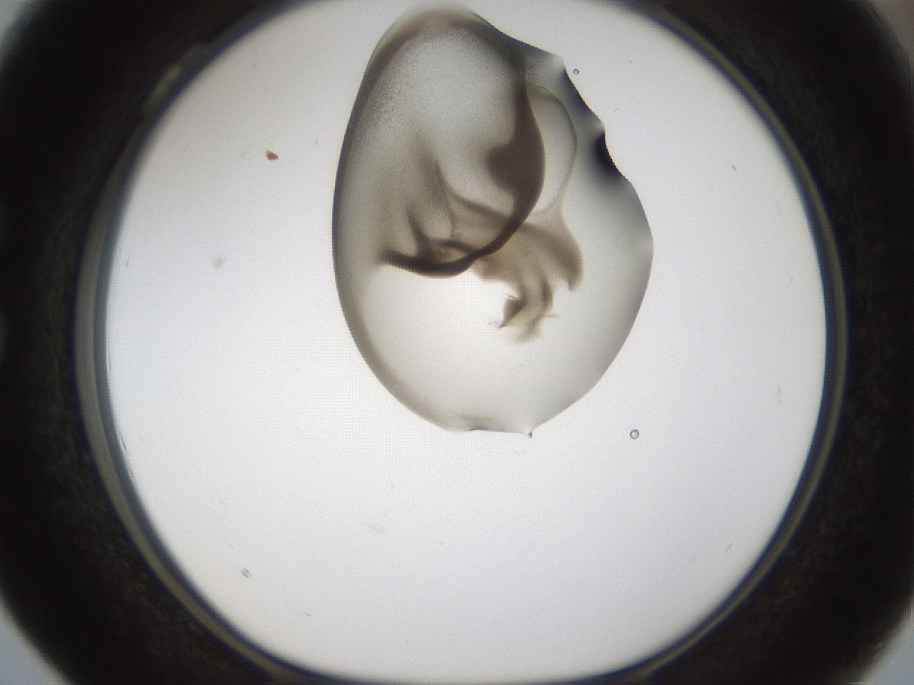 folderID160_plateID1160_batchID3204_wellNum28_profileID1_d1_r62293_ef.jpg