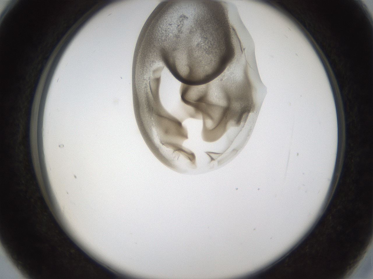 folderID160_plateID1160_batchID3204_wellNum28_profileID1_d2_r62294_ef.jpg