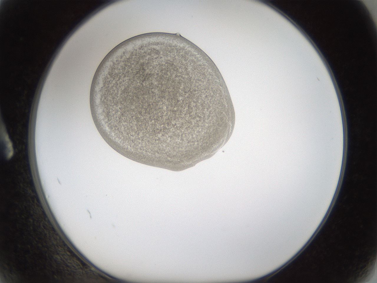folderID160_plateID1160_batchID3204_wellNum2_profileID1_d1_r62241_ef.jpg
