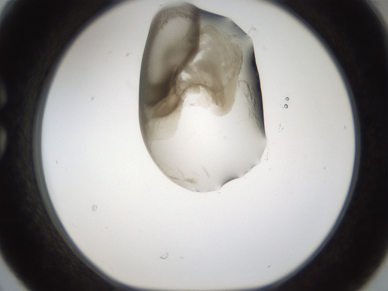 folderID160_plateID1160_batchID3204_wellNum30_profileID1_d1_r62297_ef.jpg