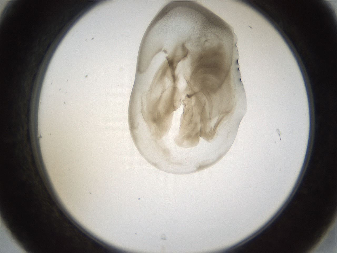 folderID160_plateID1160_batchID3204_wellNum31_profileID1_d2_r62300_ef.jpg