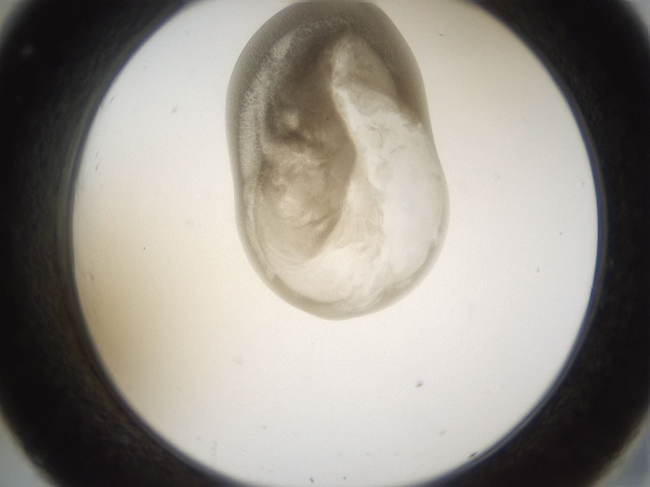 folderID160_plateID1160_batchID3204_wellNum32_profileID1_d2_r62302_ef.jpg