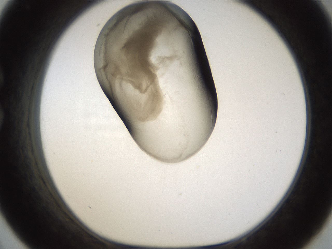 folderID160_plateID1160_batchID3204_wellNum33_profileID1_d1_r62303_ef.jpg