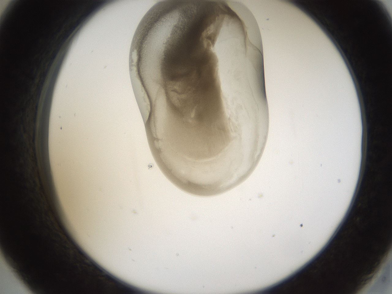 folderID160_plateID1160_batchID3204_wellNum33_profileID1_d2_r62304_ef.jpg