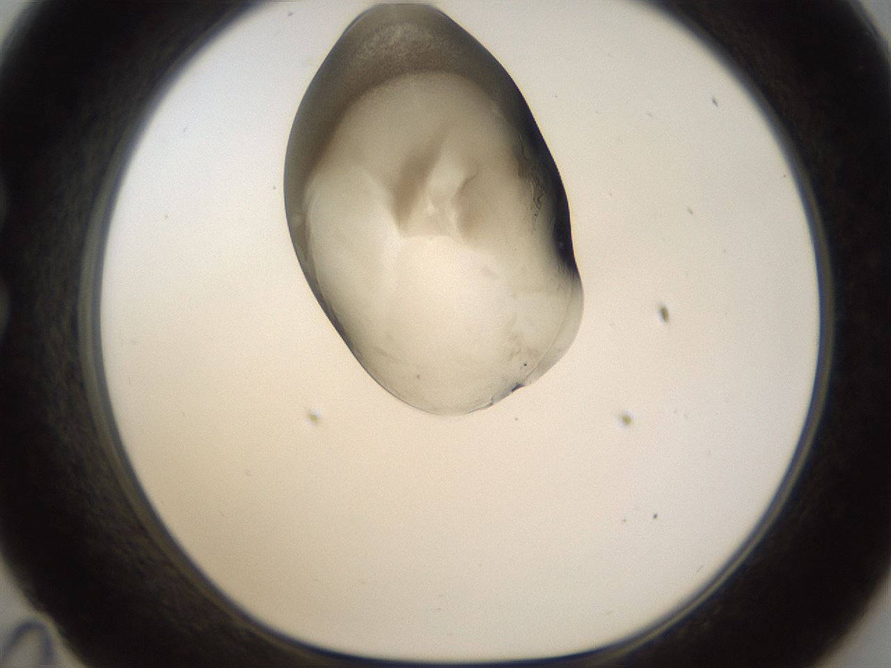 folderID160_plateID1160_batchID3204_wellNum35_profileID1_d1_r62307_ef.jpg