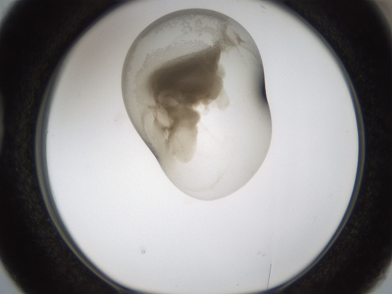 folderID160_plateID1160_batchID3204_wellNum38_profileID1_d1_r62313_ef.jpg