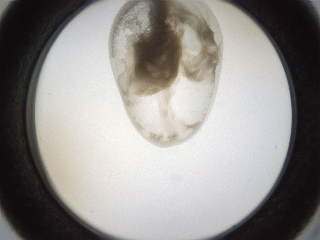 folderID160_plateID1160_batchID3204_wellNum39_profileID1_d2_r62316_ef.jpg