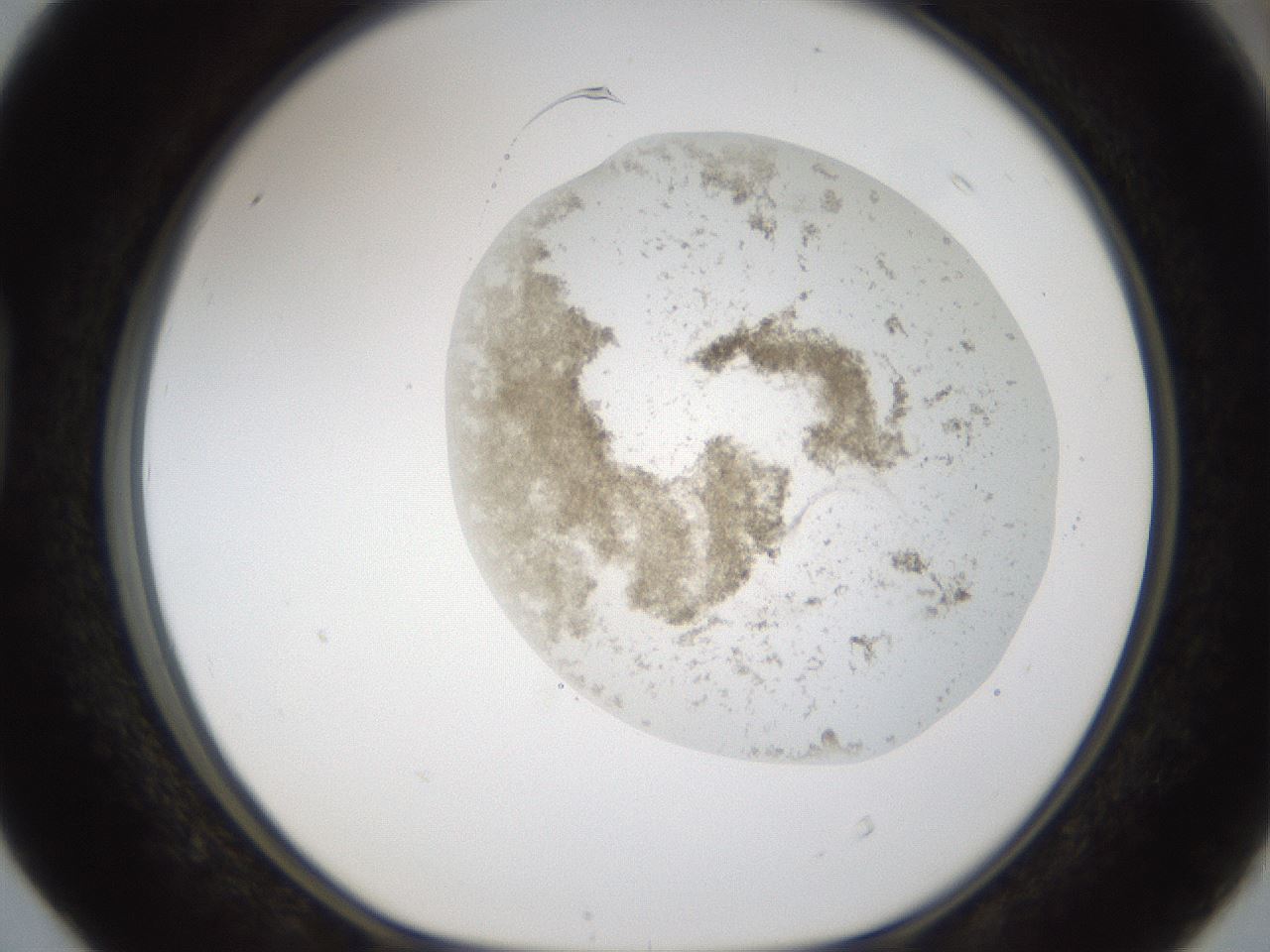 folderID160_plateID1160_batchID3204_wellNum40_profileID1_d1_r62317_ef.jpg