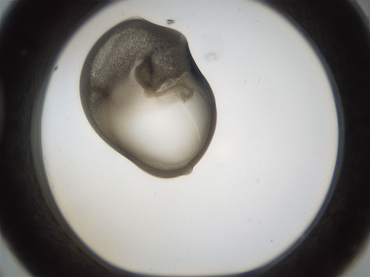 folderID160_plateID1160_batchID3204_wellNum44_profileID1_d1_r62325_ef.jpg
