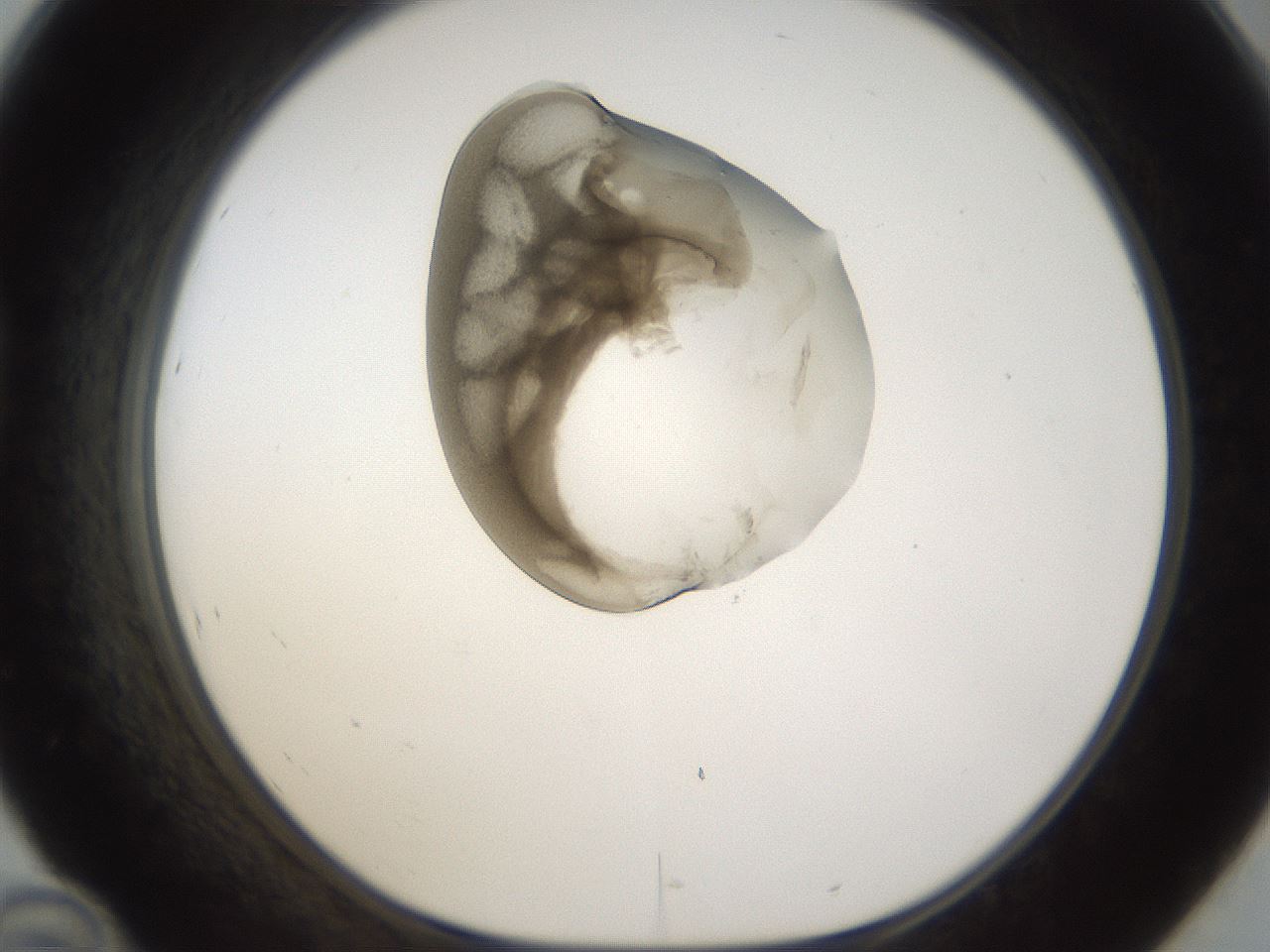 folderID160_plateID1160_batchID3204_wellNum46_profileID1_d1_r62329_ef.jpg