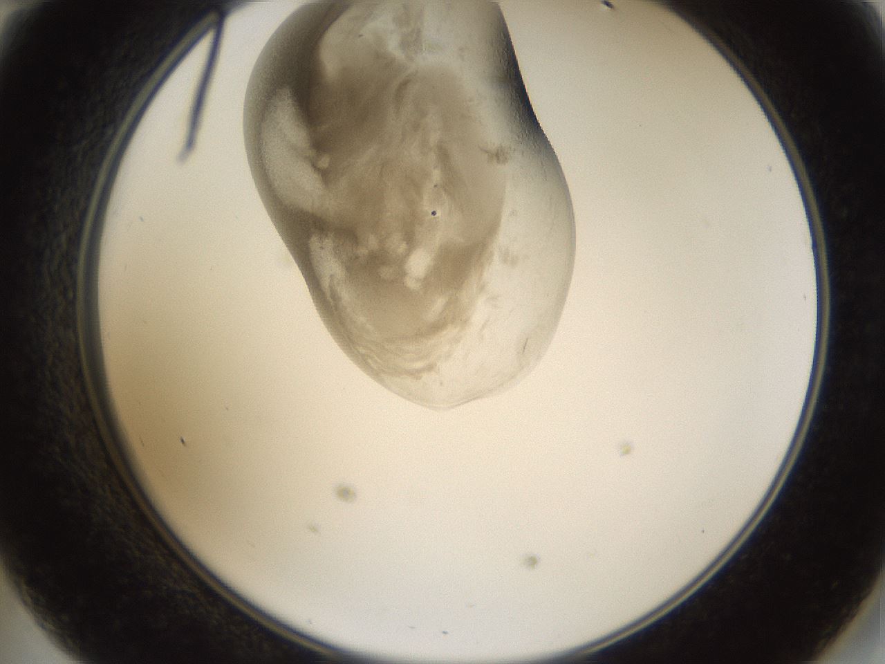 folderID160_plateID1160_batchID3204_wellNum47_profileID1_d2_r62332_ef.jpg
