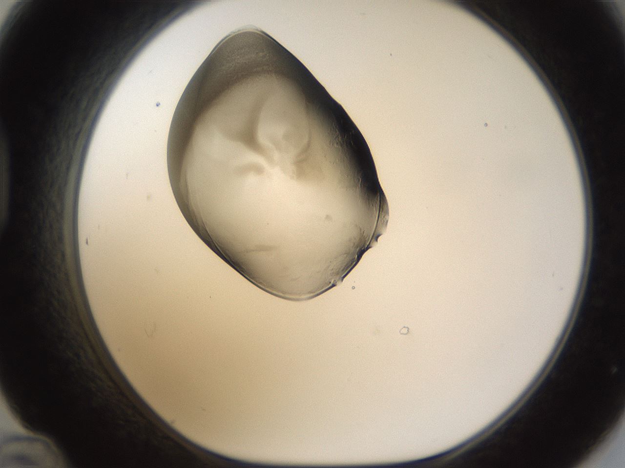 folderID160_plateID1160_batchID3204_wellNum48_profileID1_d1_r62333_ef.jpg