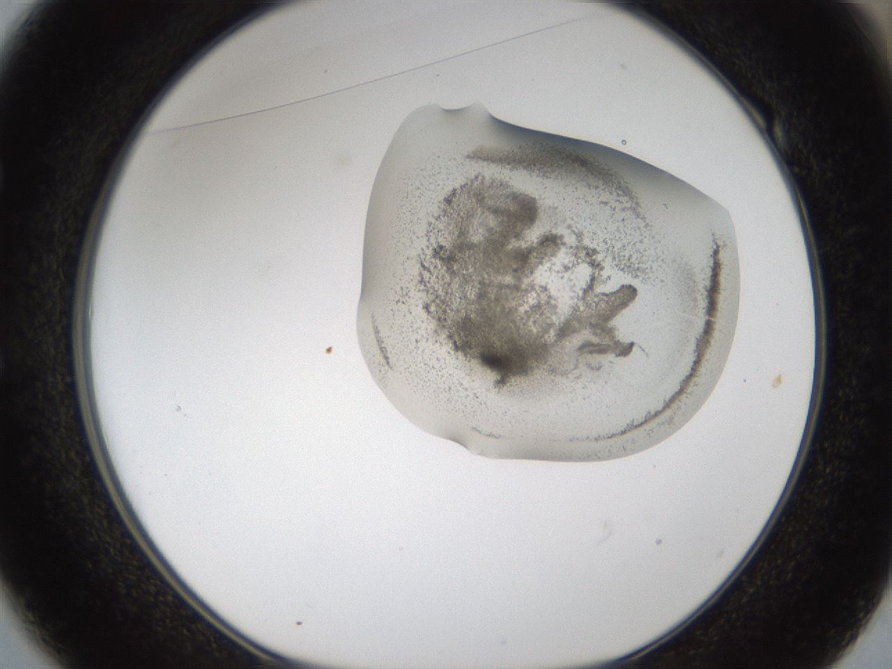 folderID160_plateID1160_batchID3204_wellNum49_profileID1_d1_r62335_ef.jpg