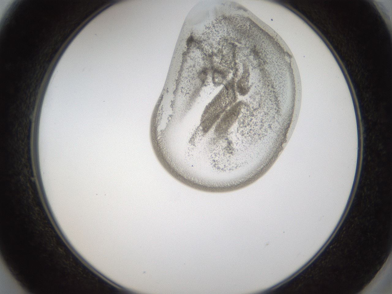 folderID160_plateID1160_batchID3204_wellNum49_profileID1_d2_r62336_ef.jpg