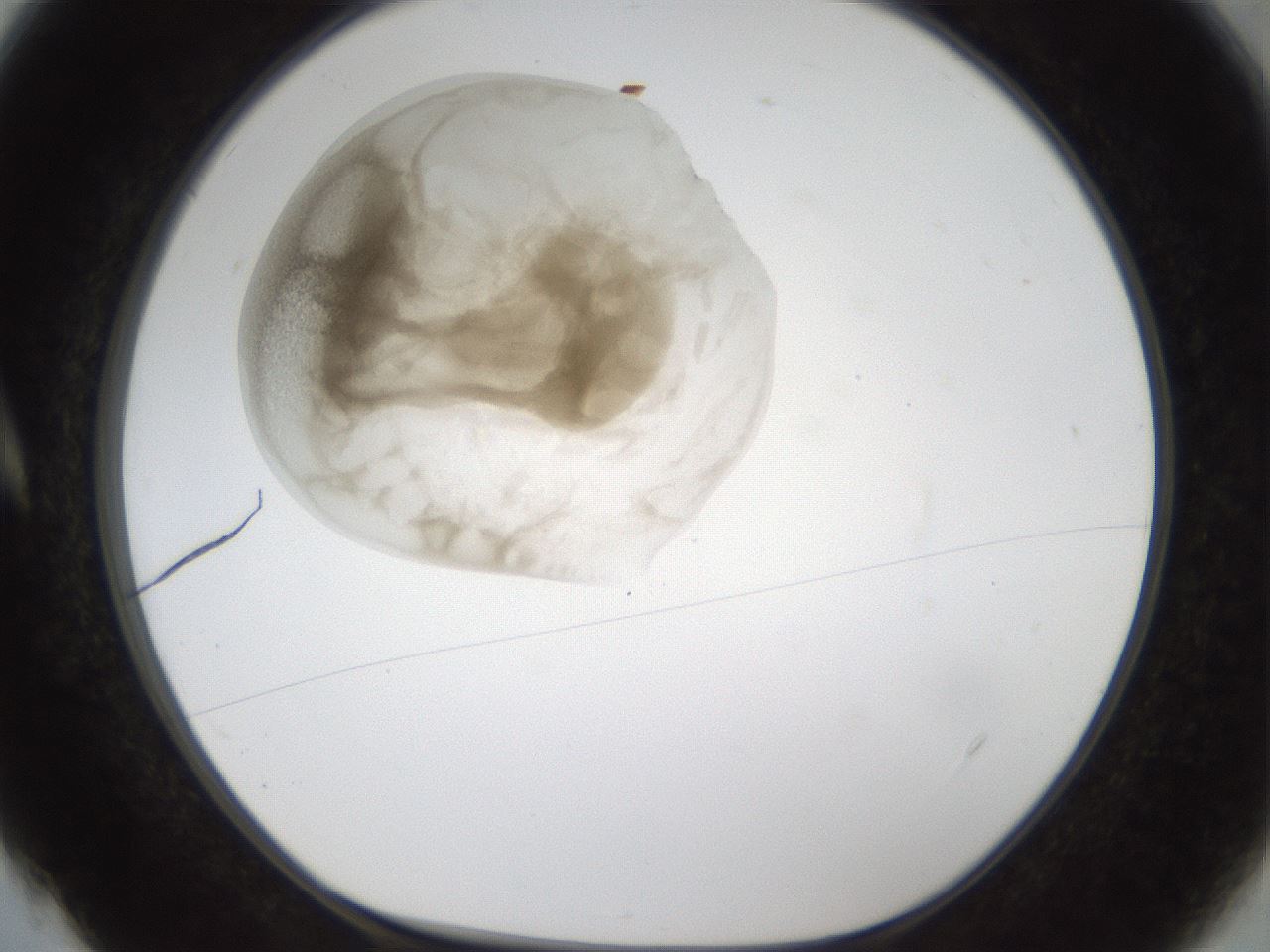 folderID160_plateID1160_batchID3204_wellNum4_profileID1_d1_r62245_ef.jpg