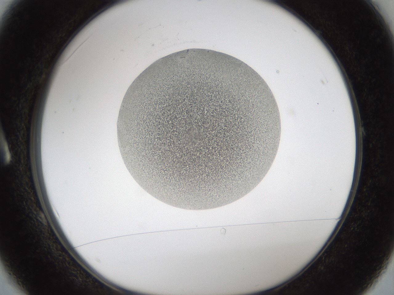 folderID160_plateID1160_batchID3204_wellNum1_profileID1_d1_r62239_ef.jpg