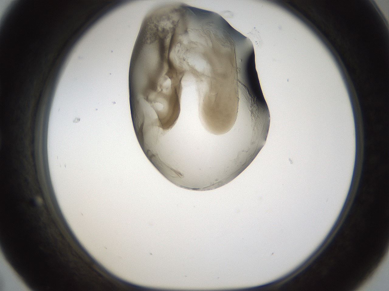 folderID160_plateID1160_batchID3204_wellNum31_profileID1_d1_r62299_ef.jpg
