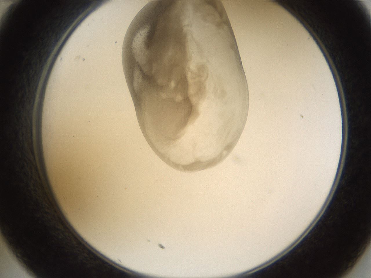folderID160_plateID1160_batchID3204_wellNum35_profileID1_d2_r62308_ef.jpg