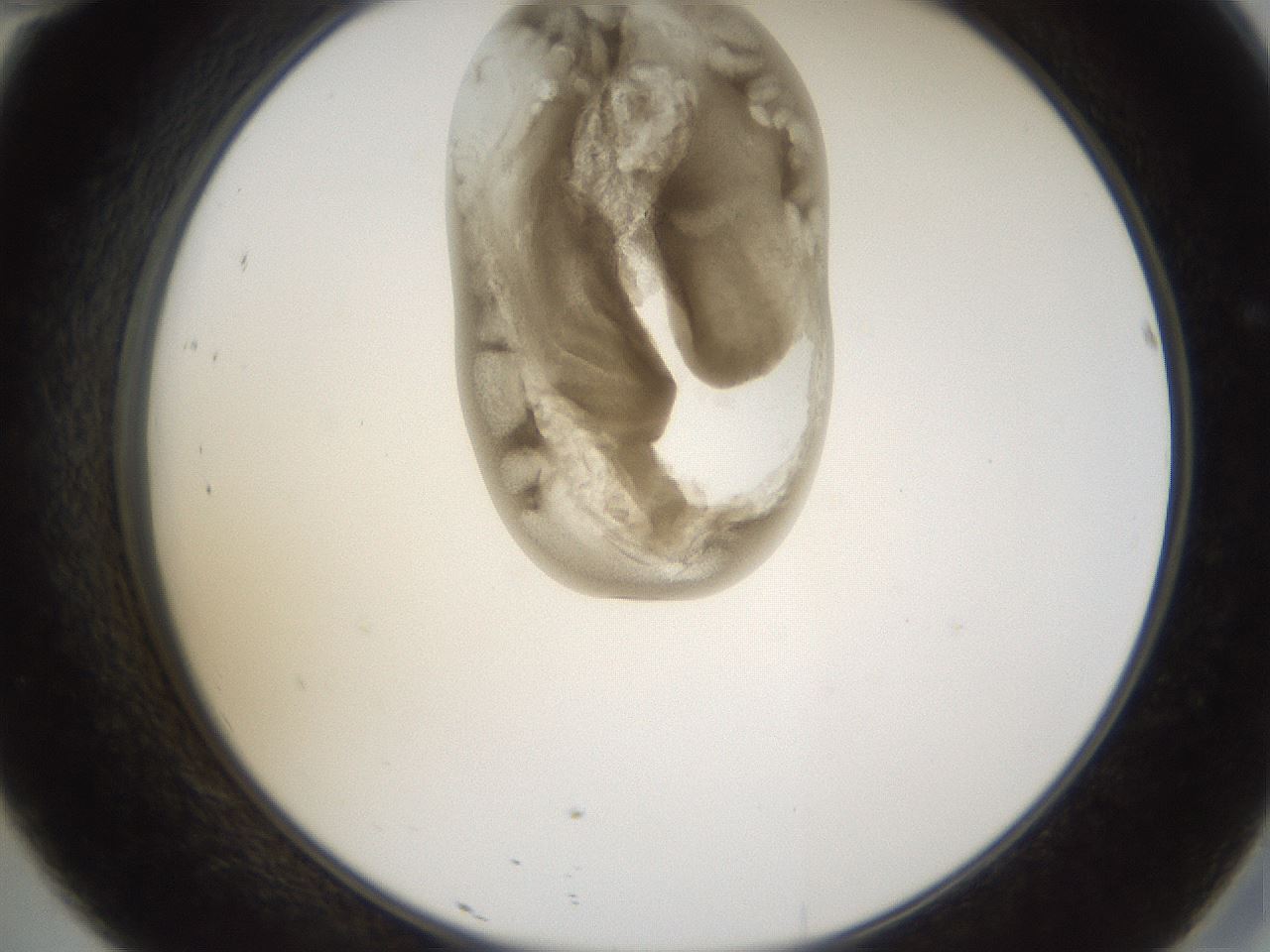 folderID160_plateID1160_batchID3204_wellNum46_profileID1_d2_r62330_ef.jpg