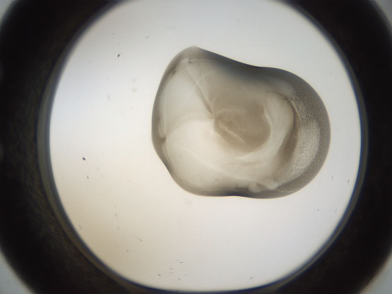 folderID160_plateID1160_batchID3204_wellNum57_profileID1_d1_r62351_ef.jpg
