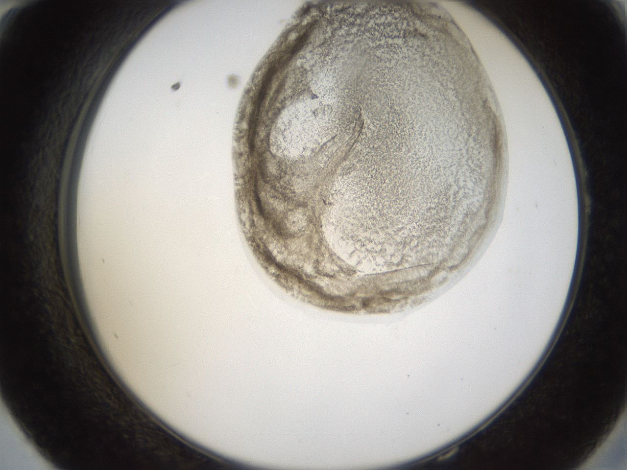 folderID160_plateID1160_batchID3204_wellNum58_profileID1_d2_r62354_ef.jpg