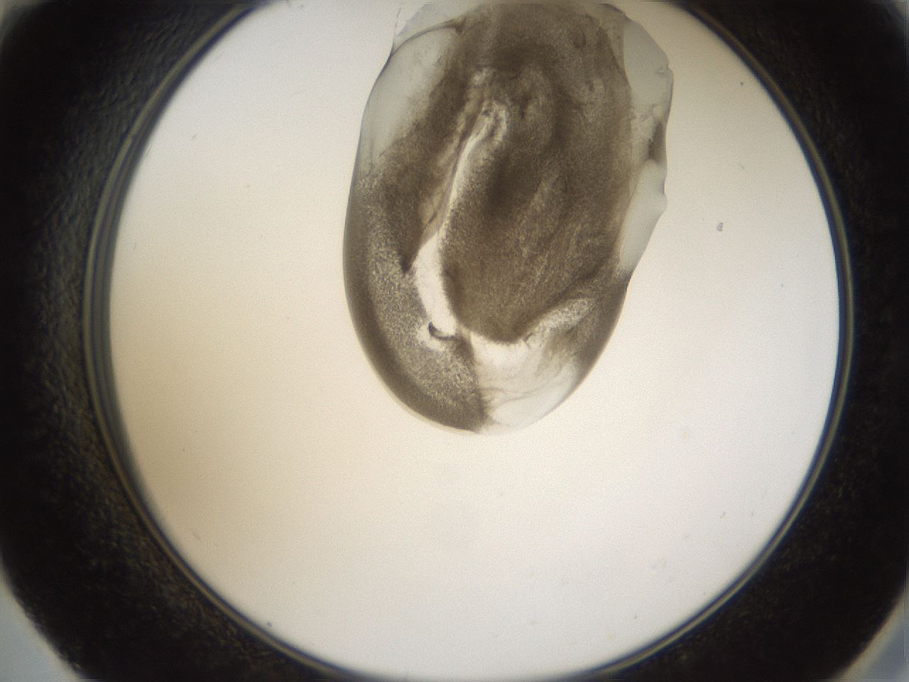 folderID160_plateID1160_batchID3204_wellNum59_profileID1_d2_r62356_ef.jpg