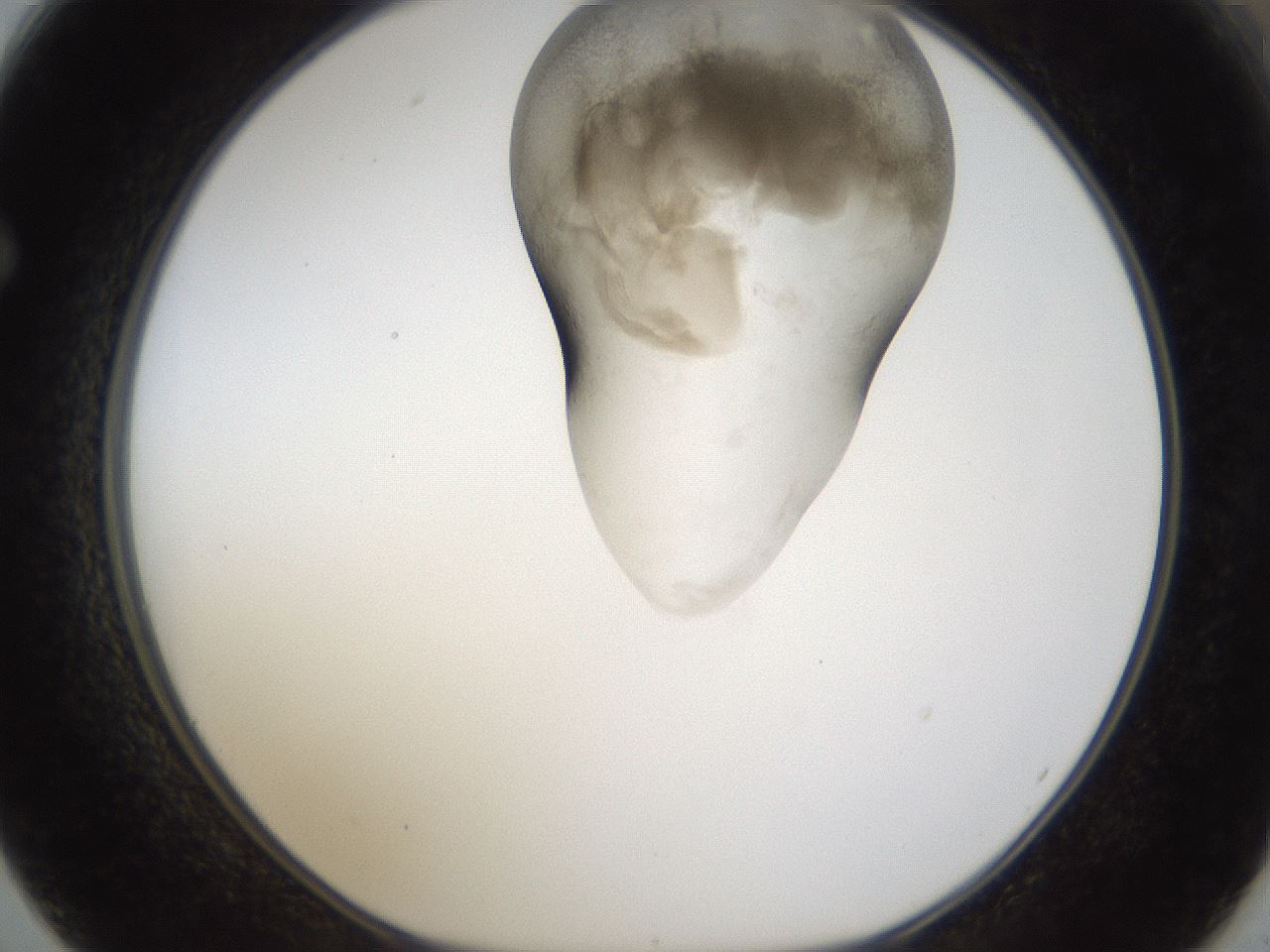folderID160_plateID1160_batchID3204_wellNum62_profileID1_d1_r62361_ef.jpg