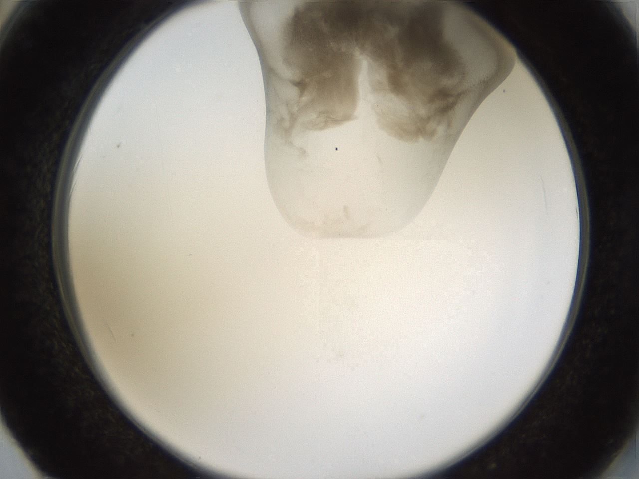 folderID160_plateID1160_batchID3204_wellNum62_profileID1_d2_r62362_ef.jpg