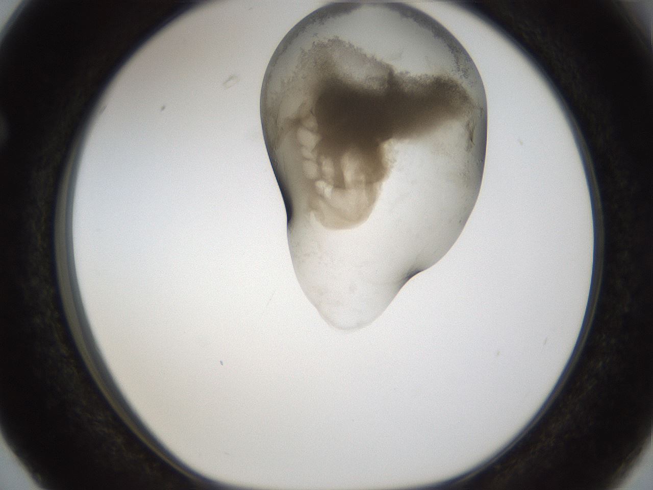 folderID160_plateID1160_batchID3204_wellNum63_profileID1_d1_r62363_ef.jpg