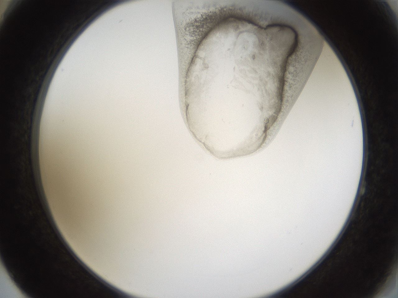 folderID160_plateID1160_batchID3204_wellNum64_profileID1_d2_r62366_ef.jpg
