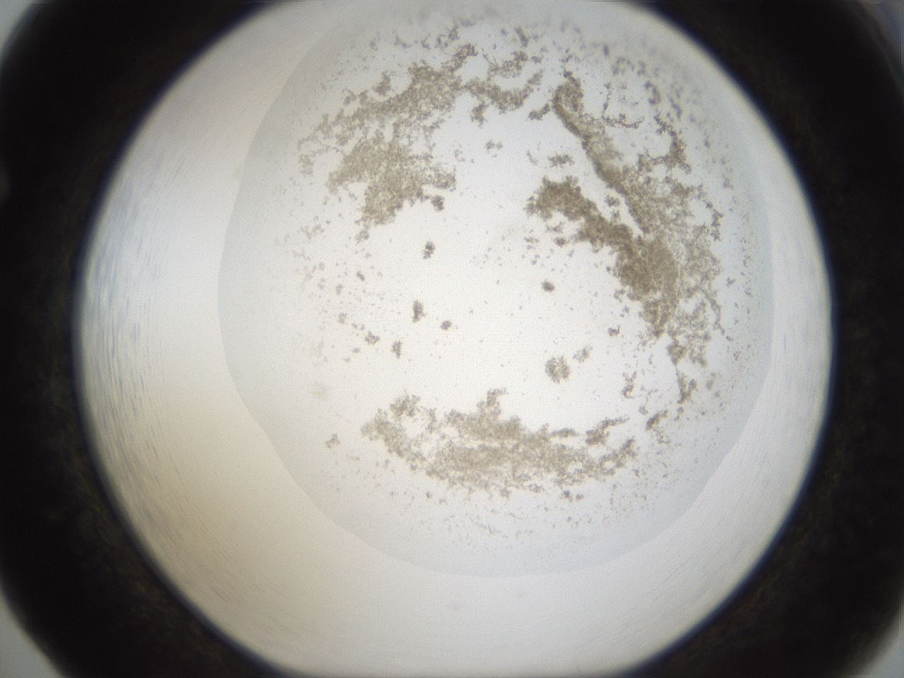 folderID160_plateID1160_batchID3204_wellNum65_profileID1_d1_r62367_ef.jpg
