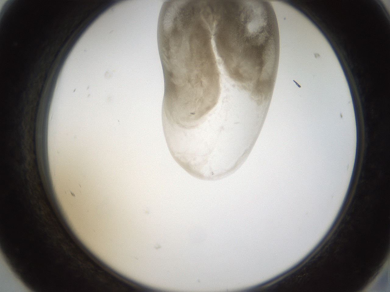 folderID160_plateID1160_batchID3204_wellNum68_profileID1_d2_r62374_ef.jpg