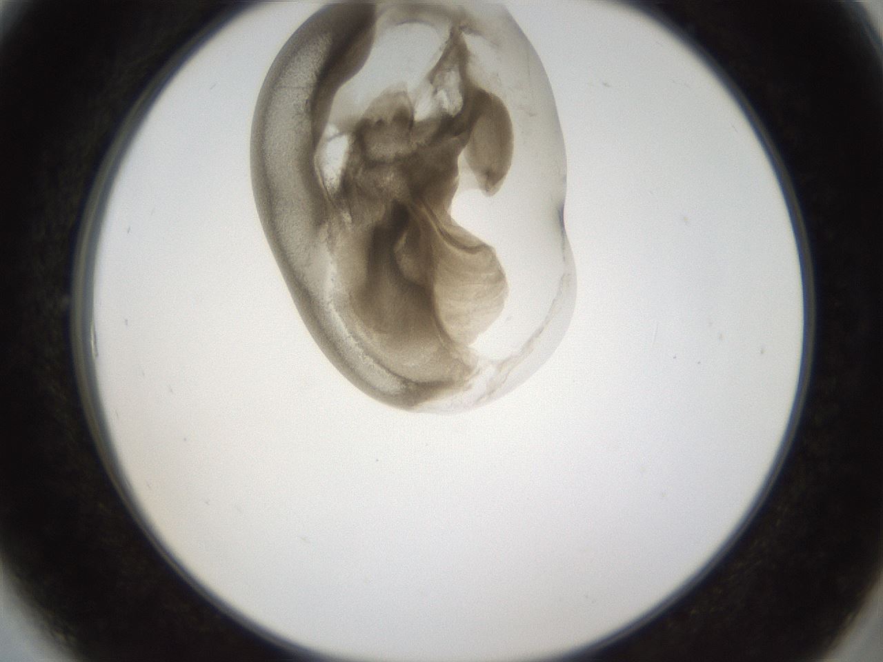 folderID160_plateID1160_batchID3204_wellNum6_profileID1_d2_r62250_ef.jpg