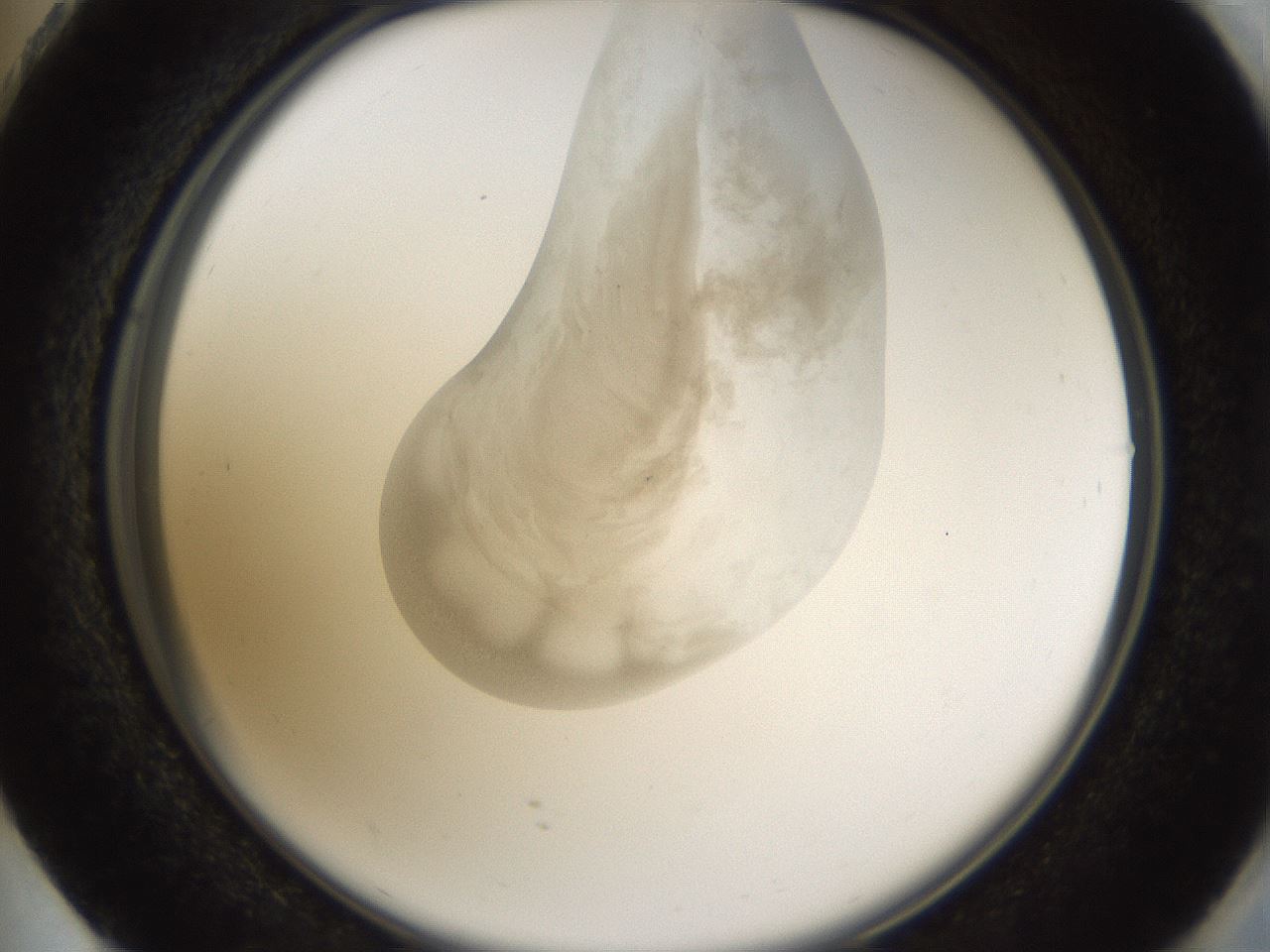 folderID160_plateID1160_batchID3204_wellNum73_profileID1_d2_r62384_ef.jpg
