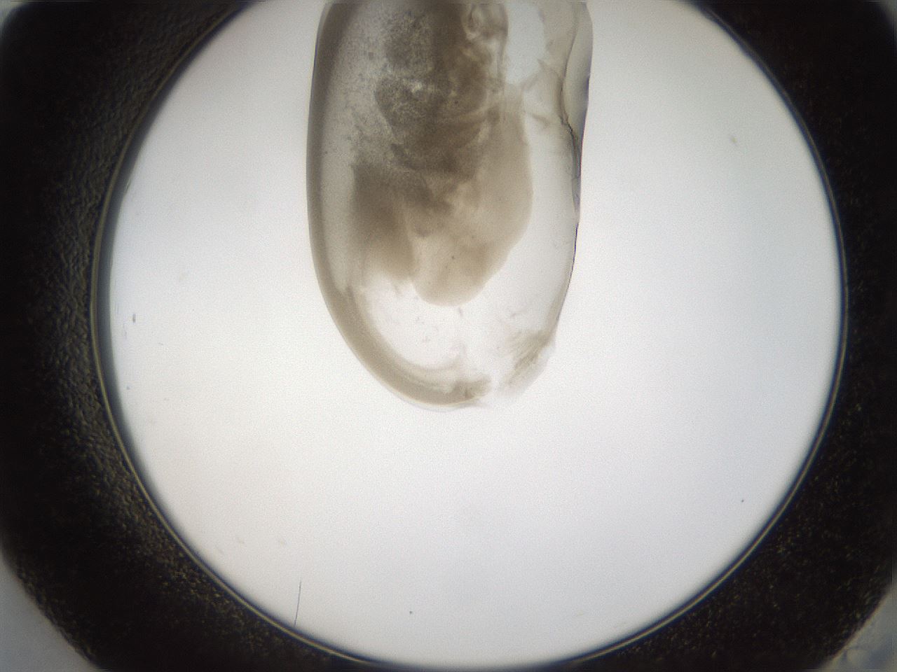 folderID160_plateID1160_batchID3204_wellNum84_profileID1_d2_r62406_ef.jpg
