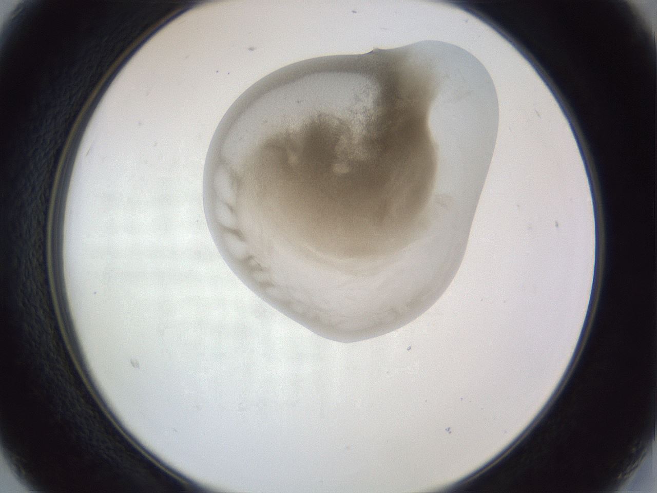 folderID161_plateID1161_batchID3209_wellNum15_profileID1_d2_r63228_ef.jpg