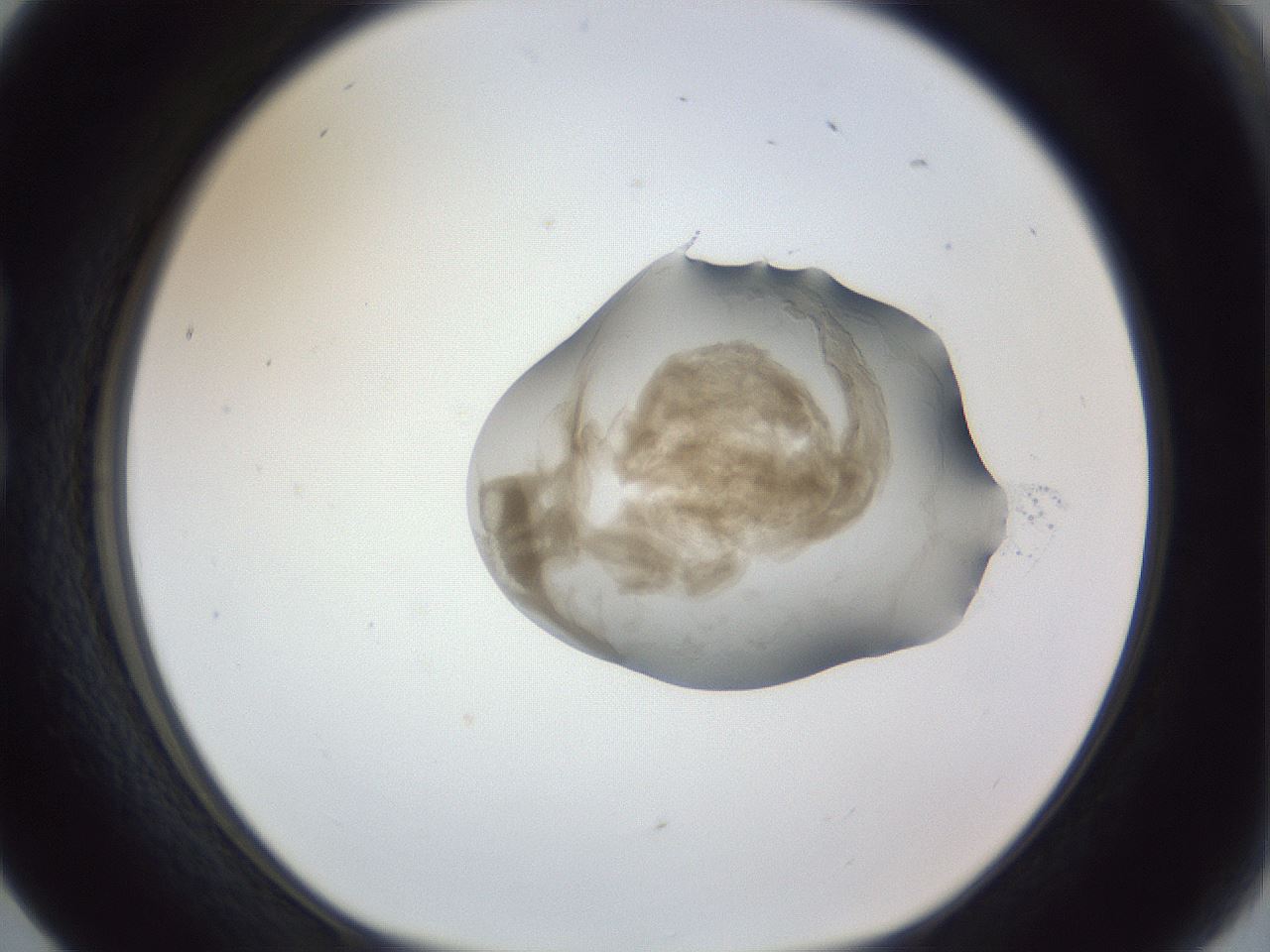 folderID161_plateID1161_batchID3209_wellNum17_profileID1_d1_r63231_ef.jpg