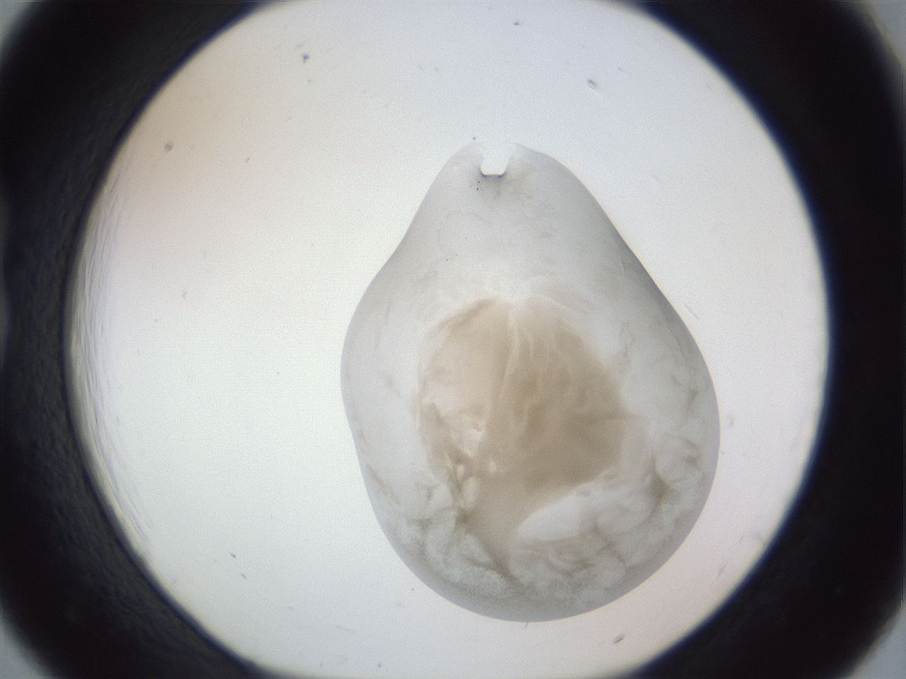 folderID161_plateID1161_batchID3209_wellNum18_profileID1_d1_r63233_ef.jpg