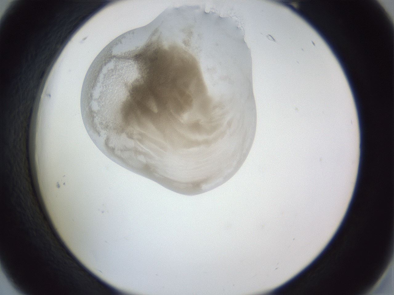 folderID161_plateID1161_batchID3209_wellNum18_profileID1_d2_r63234_ef.jpg