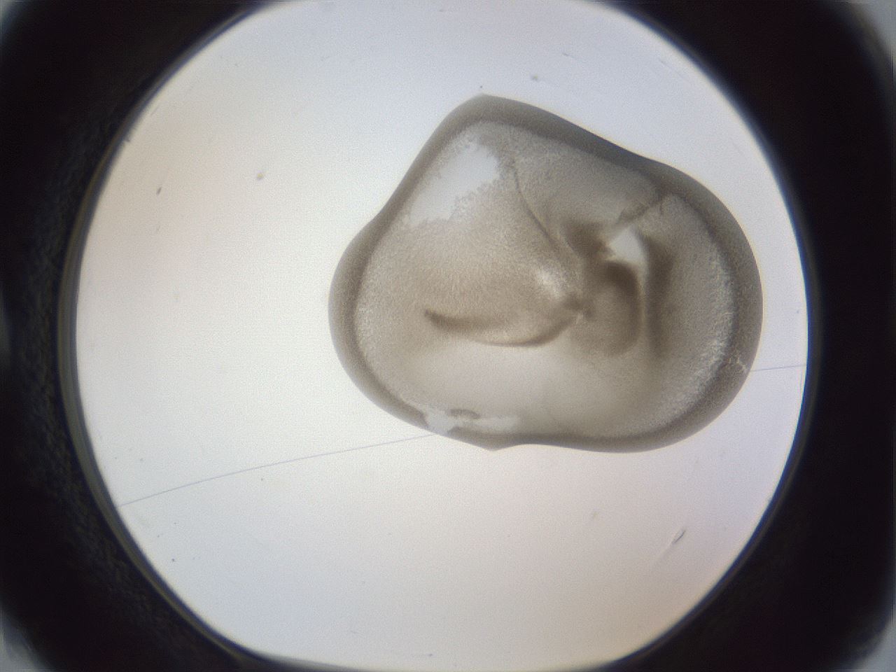 folderID161_plateID1161_batchID3209_wellNum4_profileID1_d1_r63205_ef.jpg