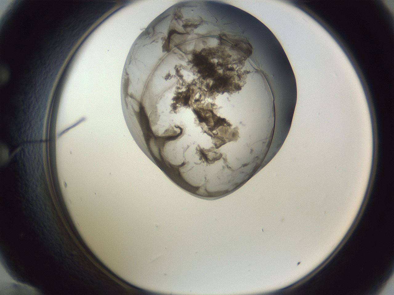 folderID161_plateID1161_batchID3209_wellNum60_profileID1_d1_r63317_ef.jpg