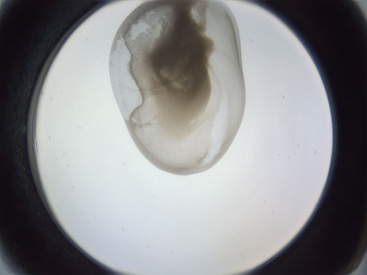 folderID161_plateID1161_batchID3209_wellNum6_profileID1_d2_r63210_ef.jpg