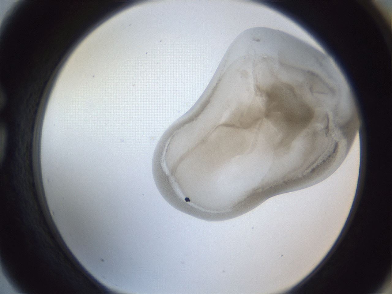 folderID161_plateID1161_batchID3209_wellNum75_profileID1_d1_r63347_ef.jpg