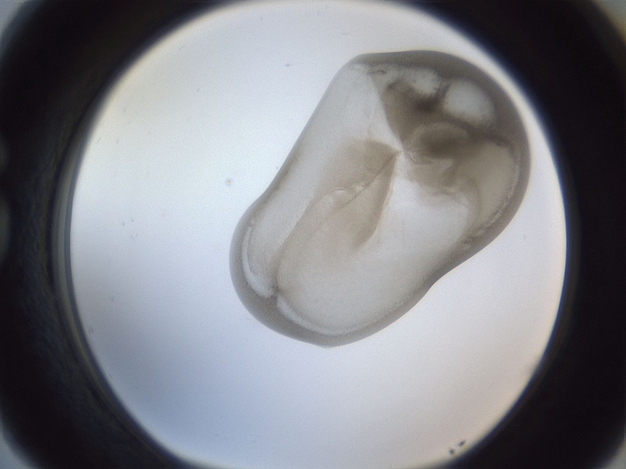 folderID161_plateID1161_batchID3209_wellNum77_profileID1_d1_r63351_ef.jpg
