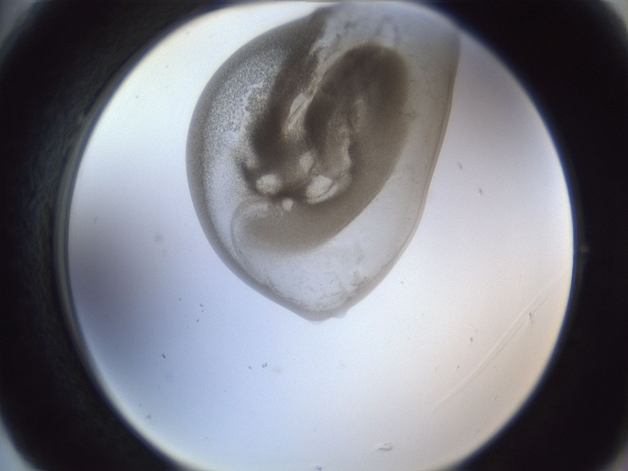 folderID161_plateID1161_batchID3209_wellNum77_profileID1_d2_r63352_ef.jpg