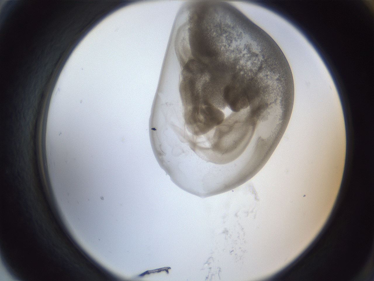 folderID161_plateID1161_batchID3209_wellNum79_profileID1_d2_r63356_ef.jpg